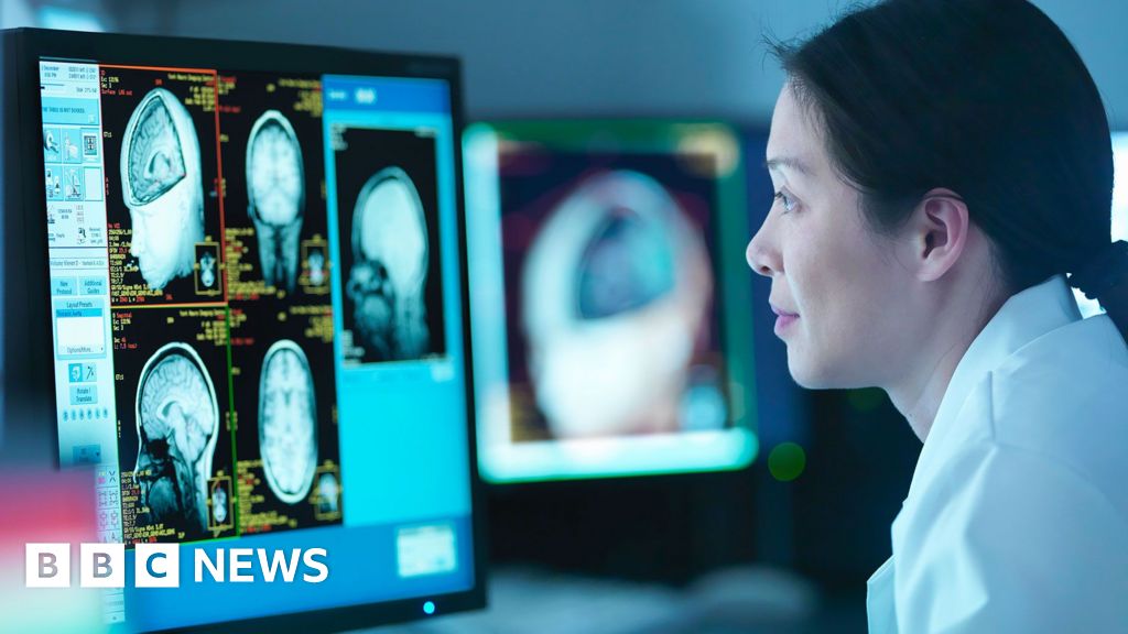 Менопауза пов'язана зі змінами в мозку, схожими на хворобу Альцгеймера