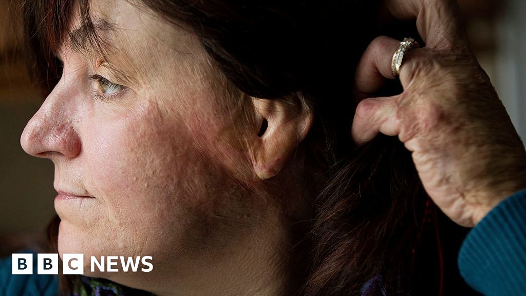 Що потрібно знати про небезпеку пожежі з ефектом спалаху