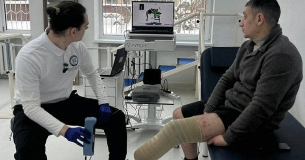 У Львові при Університетській лікарні ЛНМУ відкрили найбільшу в Європі протезну фабрику.