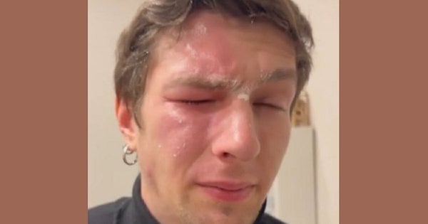 У Львові ветеран Андрій Кулько зазнав нападу від 33-річної мешканки сусіднього будинку.