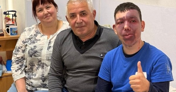 Рідкісна операція у Львові: хірурги зі США та України успішно провели складне втручання підлітку із синдромом Штурге-Вебера