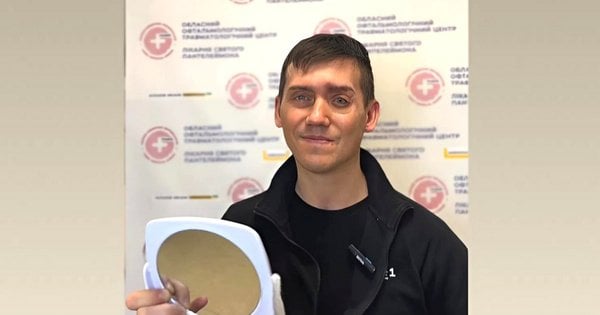 У Львові в центрі Unbroken вперше відтворили зовнішній вигляд пацієнта за допомогою протеза-накладки.