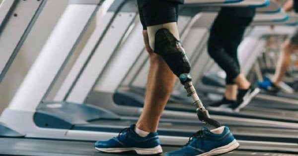 Львівська лікарня придбала біонічні колінні протези на суму 30 млн грн