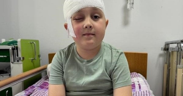 У Львові 8-річному хлопчику з Волині успішно прооперували складну пухлину мозку