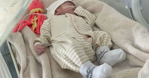 Гастрошизис: у Львові зробили операцію двом немовлятам із рідкісною хворобою