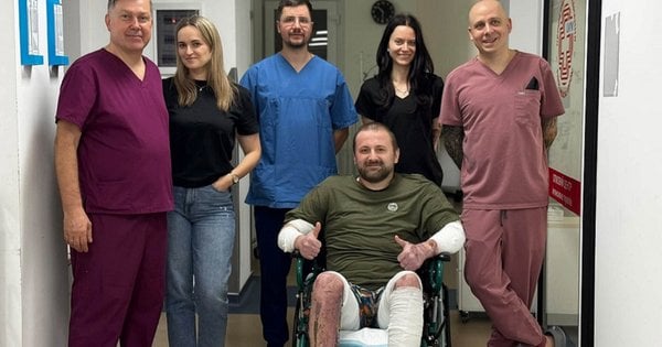 Двоє мешканців Львова зазнали опіків 80% тіла через вибух бойлера