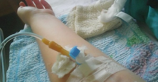 Нелікований гайморит викликав у 56-річної львів’янки інфекційне ураження мозку